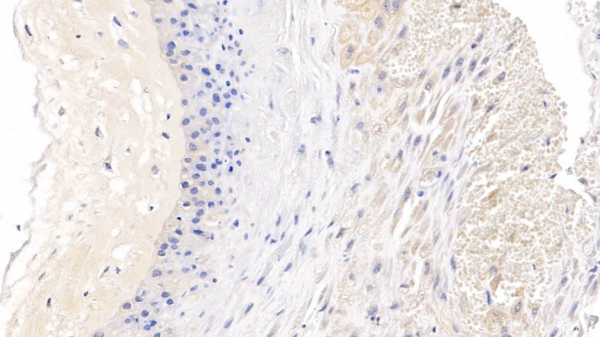 DAB staining on IHC-P; Sample: Human Liver Tissue; Primary Ab: 30ug/ml Mouse Anti-Human ROS1 Antibody; Second Ab: 2ug/mL HRP-Linked Caprine Anti-Mouse IgG Polyclonal Antibody