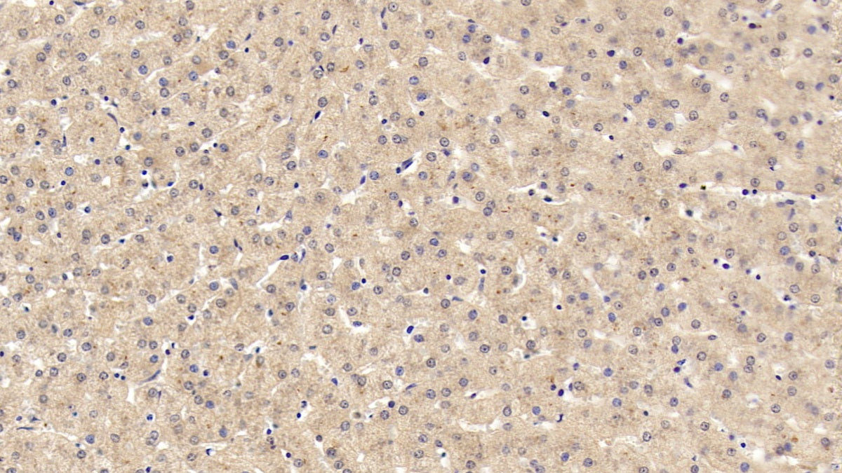 C-Ros Oncogene 1, Receptor Tyrosine Kinase (ROS1) Monoclonal Antibody - image 3