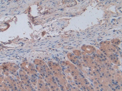 Chemokine (C-X-C Motif) Ligand 1 (CXCL1) Monoclonal Antibody - image 2
