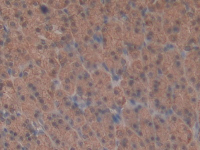 DAB staining on IHC-P; Sample: Rat Liver Tissue; Primary Ab: 30ug/ml Mouse Anti-Rat NAP3 Antibody; Second Ab: 2ug/mL HRP-Linked Caprine Anti-Mouse IgG Polyclonal Antibody