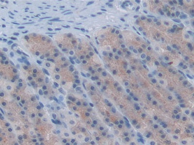 Chemokine (C-X-C Motif) Ligand 1 (CXCL1) Monoclonal Antibody - image 2