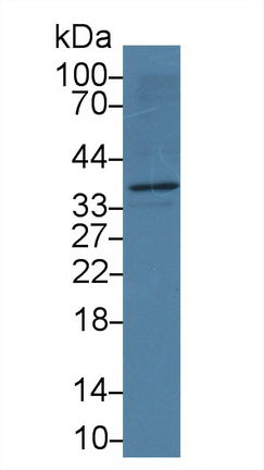 Apolipoprotein L2 (APOL2) Monoclonal Antibody - image 2