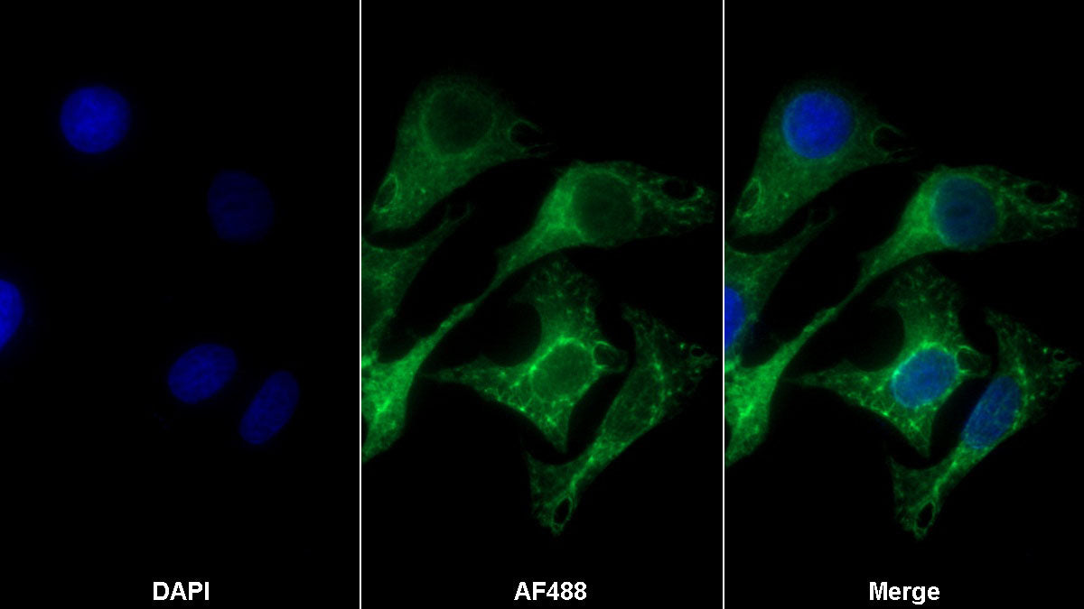 Western Blot; Sample: Lane1: Human Lung lysate; Lane2: Porcine Heart lysate; Lane3: Hela cell lysate Primary Ab: 3ug/ml Mouse Anti-Human Hsp27 Antibody Second Ab: 0.2ug/mL HRP-Linked Caprine Anti-Mouse IgG Polyclonal Antibody
