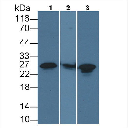 Heat Shock Protein 27 (Hsp27) Monoclonal Antibody - image 3