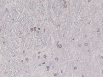 DAB staining on IHC-P; Sample: Rat Adrenal gland Tissue; Primary Ab: 20ug/ml Mouse Anti-Rat HSPb6 Antibody; Second Ab: 2ug/mL HRP-Linked Caprine Anti-Mouse IgG Polyclonal Antibody
