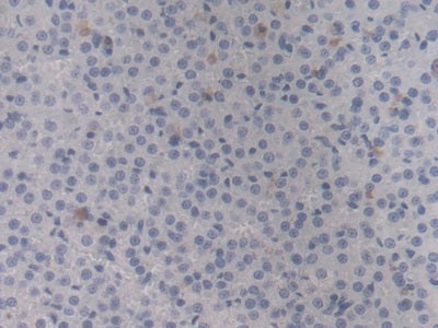 DAB staining on IHC-P; Sample: Rat Stomach Tissue; Primary Ab: 20ug/ml Mouse Anti-Rat HSPb6 Antibody; Second Ab: 2ug/mL HRP-Linked Caprine Anti-Mouse IgG Polyclonal Antibody