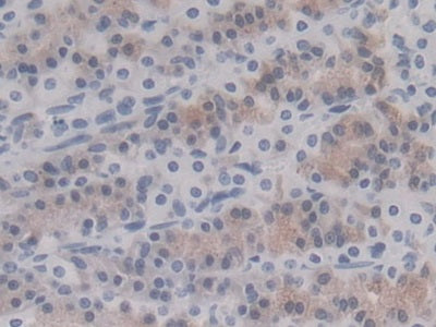 DAB staining on IHC-P; Sample: Rat Cardiac Muscle Tissue; Primary Ab: 20ug/ml Mouse Anti-Rat HSPb6 Antibody; Second Ab: 2ug/mL HRP-Linked Caprine Anti-Mouse IgG Polyclonal Antibody
