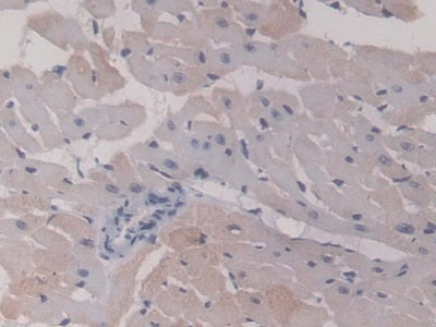 Heat Shock Protein Beta 6 (HSPb6) Monoclonal Antibody - image 5