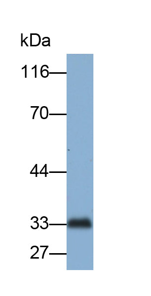 Superoxide Dismutase 3, Extracellular (SOD3) Monoclonal Antibody - image 2