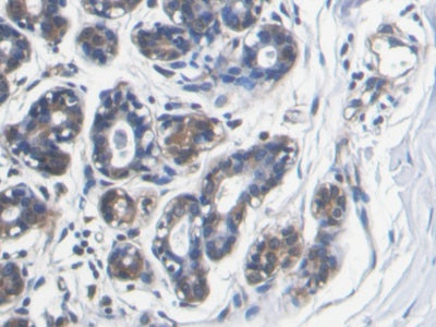 AF488 staining on IF; Sample: MCF7 cell; Primary Ab: 30ug/ml Mouse Anti-Human S100A8 Antibody; Second Ab: 2ug/ml AF488-Linked Caprine Anti-Mouse IgG Polyclonal Antibody