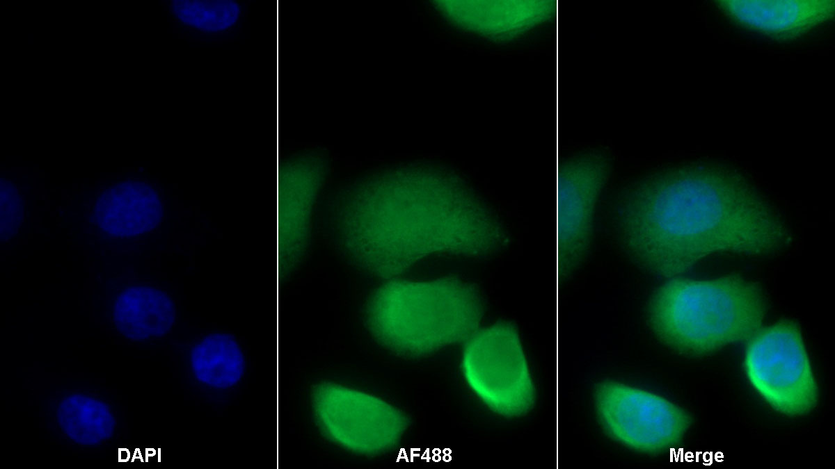 Western Blot; Sample: Lane1: Human Saliva; Lane2: Human Leukocyte lysate; Lane3: Human Lymphocyte lysate Primary Ab: 0.1ug/ml Mouse Anti-Human S100A8 Antibody Second Ab: 0.2ug/mL HRP-Linked Caprine Anti-Mouse IgG Polyclonal Antibody