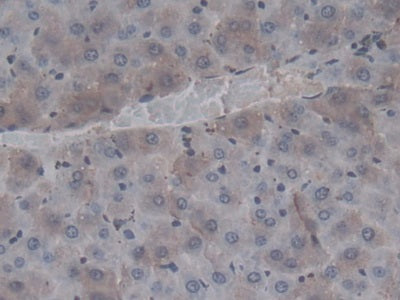 DAB staining on IHC-P; Sample: Rat Liver Tissue; Primary Ab: 20ug/ml Mouse Anti-Rat F2 Antibody; Control: Used PBS instead of primary antibody; Second Ab: 2ug/ml HRP-Linked Caprine Anti-Mouse IgG Polyclonal Antibody