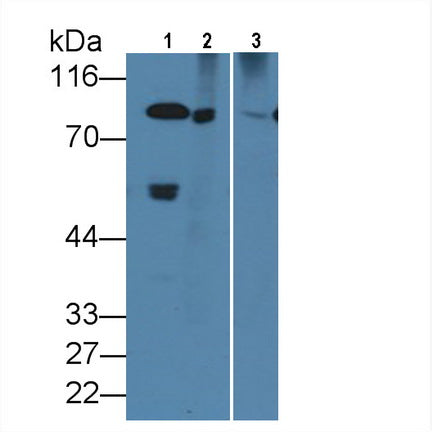 Coagulation Factor II (F2) Monoclonal Antibody - image 4