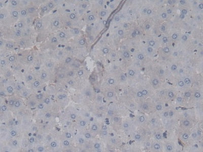 Western Blot; Sample: Lane1: Rat Serum; Lane2: Rat Liver lysate; Lane3: Rat Spleen lysate Primary Ab: 1ug/ml Mouse Anti-Rat F2 Antibody Second Ab: 0.2ug/mL HRP-Linked Caprine Anti-Mouse IgG Polyclonal Antibody