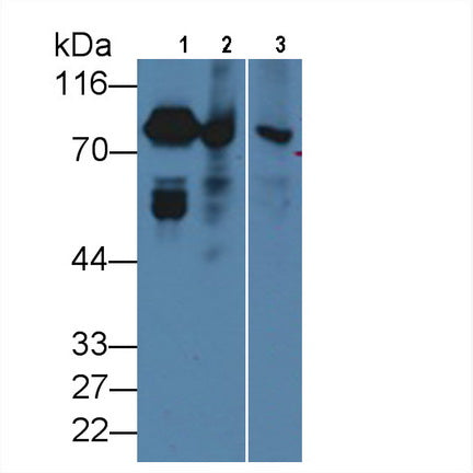 Coagulation Factor II (F2) Monoclonal Antibody - image 3