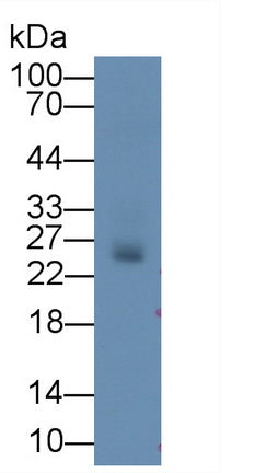 Deoxythymidylate Kinase (DTYMK) Monoclonal Antibody - image 3