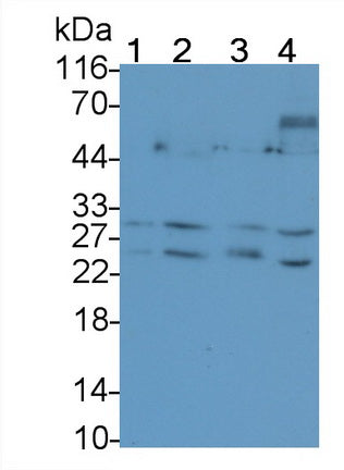 Tumor Necrosis Factor Related Apoptosis Inducing Ligand (TRAIL) Monoclonal Antibody - image 3