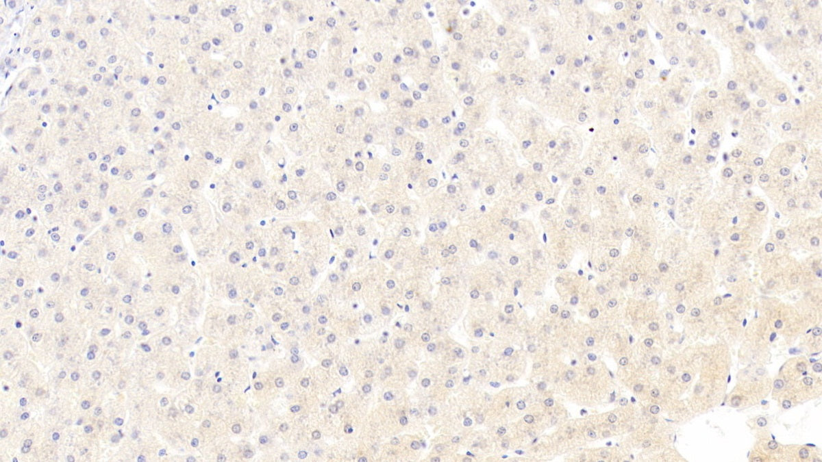 DAB staining on IHC-P; Samples: Human Cerebrum Tissue; Primary Ab: 30ug/ml Mouse Anti-Human bACE1 Antibody; Second Ab: 2ug/mL HRP-Linked Caprine Anti-Mouse IgG Polyclonal Antibody