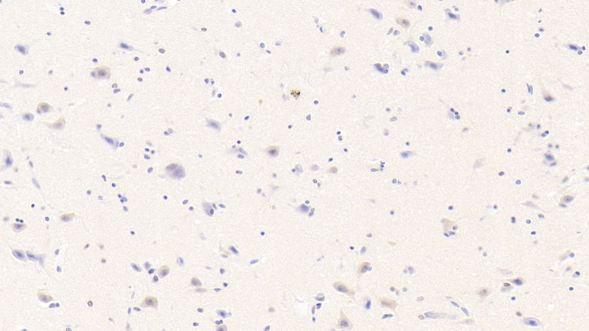 Beta-Site APP Cleaving Enzyme 1 (bACE1) Monoclonal Antibody - image 3