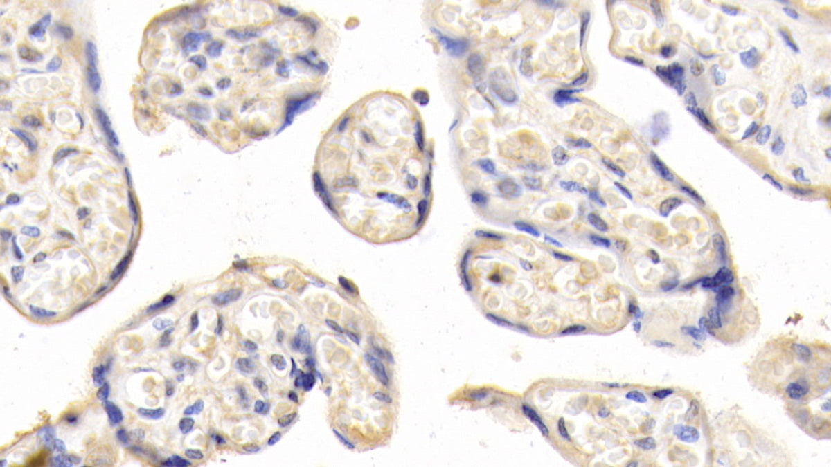DAB staining on IHC-P; Samples: Human Cardiac Muscle Tissue; Primary Ab: 20ug/ml Mouse Anti-Human LEP Antibody; Second Ab: 2ug/mL HRP-Linked Caprine Anti-Mouse IgG Polyclonal Antibody