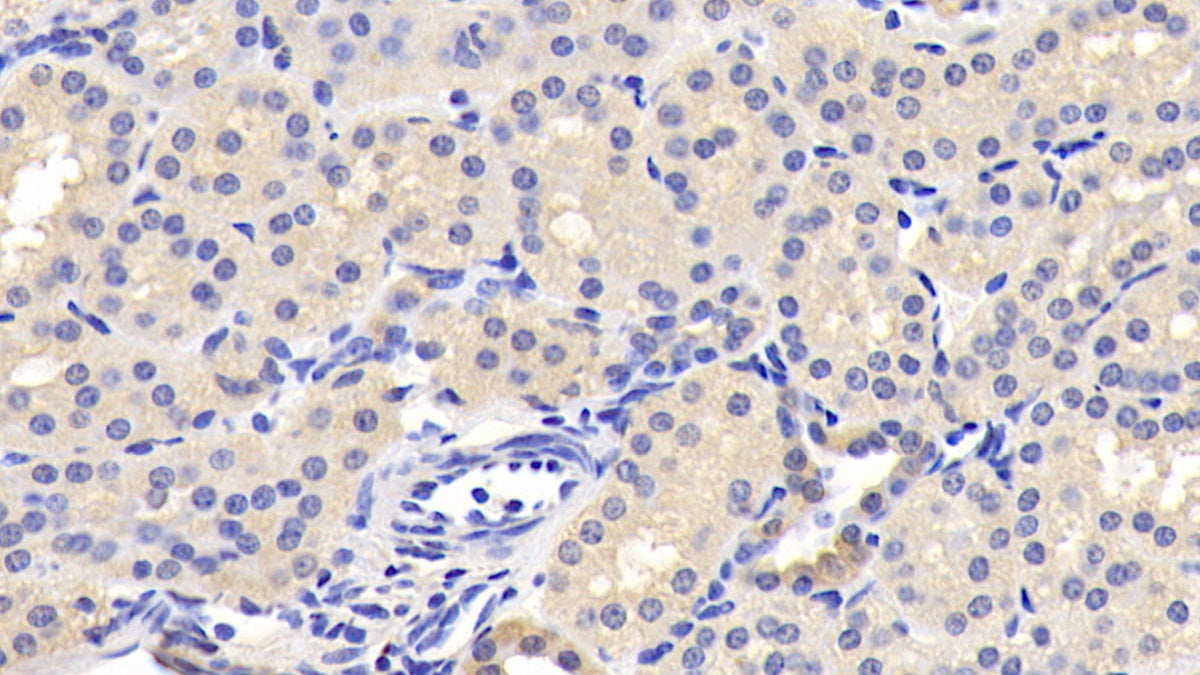 DAB staining on IHC-P; Samples: Human Cerebrum Tissue; Primary Ab: 20ug/ml Mouse Anti-Human LEP Antibody; Second Ab: 2ug/mL HRP-Linked Caprine Anti-Mouse IgG Polyclonal Antibody