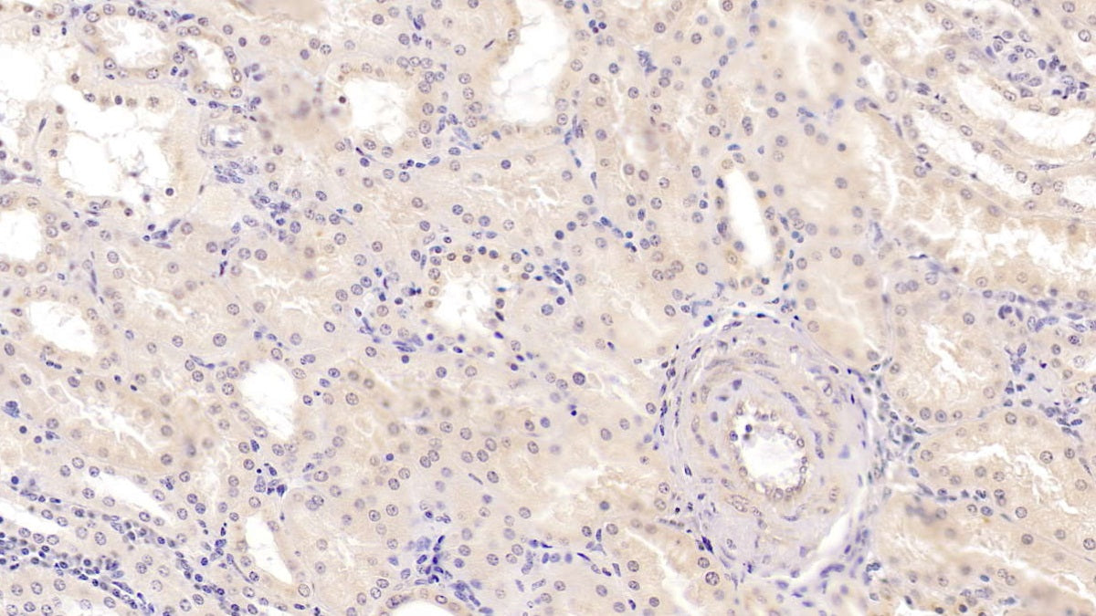 Methionine Sulfoxide Reductase A (MSRA) Monoclonal Antibody - image 2