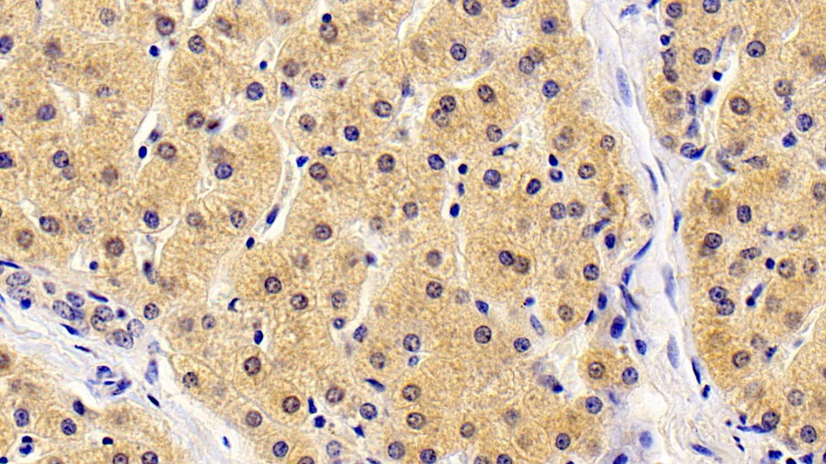 Thymic Stromal Lymphopoietin (TSLP) Monoclonal Antibody - image 2