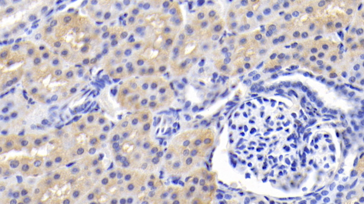 Brain Specific Angiogenesis Inhibitor 3 (BAI3) Monoclonal Antibody - image 2
