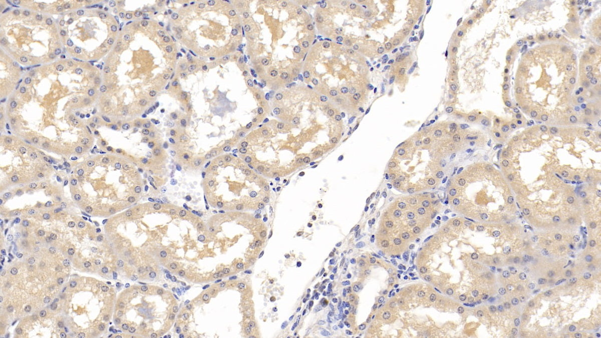 Squamous Cell Carcinoma Antigen 1/2 (SCCA1/SCCA2) Monoclonal Antibody - image 2