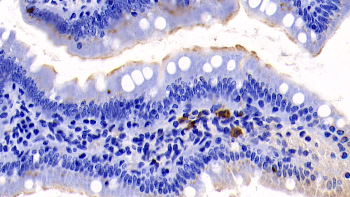 DAB staining on IHC-P; Sample: Rat Colon Tissue; Primary Ab: 30ug/ml Mouse Anti-Rat IL17 Antibody; Second Ab: 2ug/mL HRP-Linked Caprine Anti-Mouse IgG Polyclonal Antibody