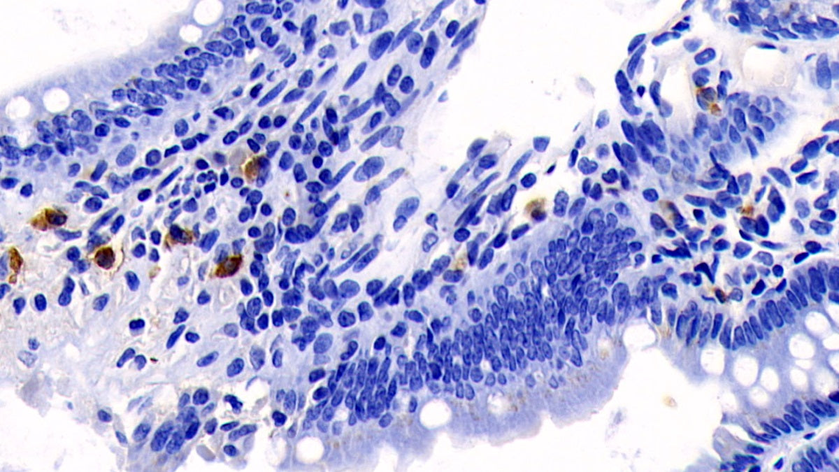 Interleukin 17 (IL17) Monoclonal Antibody - image 3