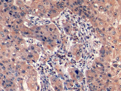 DAB staining on IHC-P; Sample: Human Tonsil Tissue; Primary Ab: 10ug/ml Mouse Anti-Human HAVCR2 Antibody; Second Ab: 2ug/mL HRP-Linked Caprine Anti-Mouse IgG Polyclonal Antibody