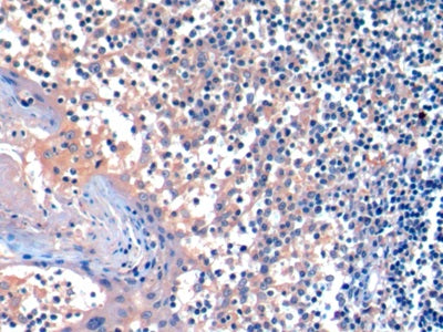 AF488 staining on IF; Sample: Raji cell; Primary Ab: 20ug/ml Mouse Anti-Human HAVCR2 Antibody; Second Ab: 2ug/ml AF488-Linked Caprine Anti-Mouse IgG Polyclonal Antibody