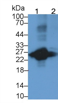 T-Cell Surface Glycoprotein CD3 Epsilon (CD3e) Monoclonal Antibody - image 2