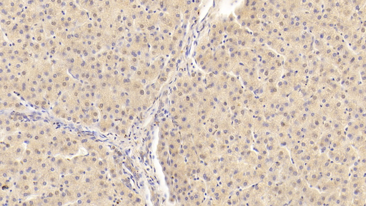 Western Blot; Sample: Human Serum Primary Ab: 3ug/ml Mouse Anti-Human APOB Antibody Second Ab: 0.2ug/mL HRP-Linked Caprine Anti-Mouse IgG Polyclonal Antibody