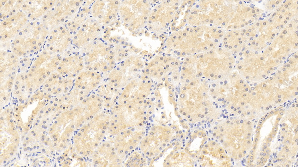 DAB staining on IHC-P; Sample: Human Cerebrum Tissue; Primary Ab: 30ug/ml Mouse Anti-Human NRGN Antibody; Control: Used PBS instead of primary antibody; Second Ab: 2ug/ml HRP-Linked Caprine Anti-Mouse IgG Polyclonal Antibody