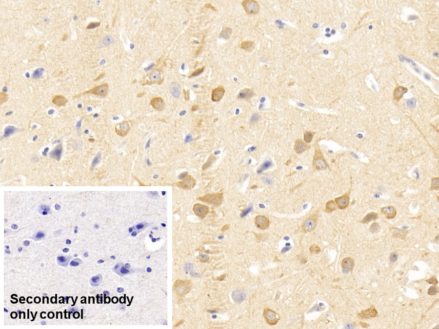 DAB staining on IHC-P; Sample: Human Kidney Tissue; Primary Ab: 30ug/ml Mouse Anti-Human NRGN Antibody; Control: Used PBS instead of primary antibody; Second Ab: 2ug/ml HRP-Linked Caprine Anti-Mouse IgG Polyclonal Antibody