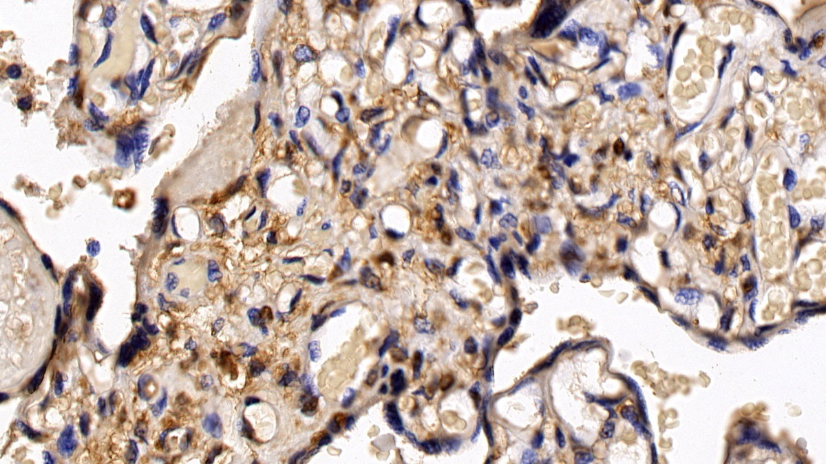 DAB staining on IHC-P; Sample: Human Pancreas Tissue; Primary Ab: 20ug/ml Mouse Anti-Human HDAC1 Antibody; Second Ab: 2ug/mL HRP-Linked Caprine Anti-Mouse IgG Polyclonal Antibody