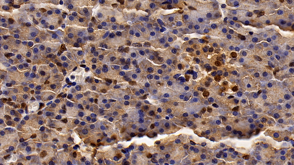 DAB staining on IHC-P; Sample: Human Spinal cord Tissue; Primary Ab: 20ug/ml Mouse Anti-Human HDAC1 Antibody; Second Ab: 2ug/mL HRP-Linked Caprine Anti-Mouse IgG Polyclonal Antibody
