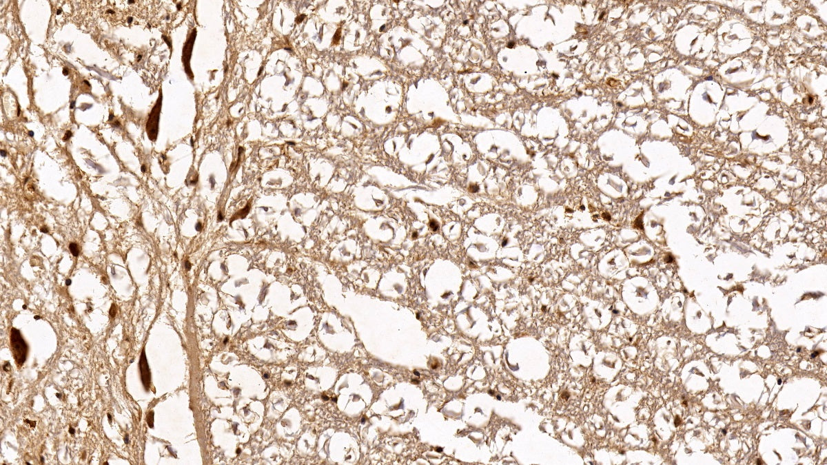 DAB staining on IHC-P; Sample: Human Kidney Tissue; Primary Ab: 20ug/ml Mouse Anti-Human HDAC1 Antibody; Second Ab: 2ug/mL HRP-Linked Caprine Anti-Mouse IgG Polyclonal Antibody