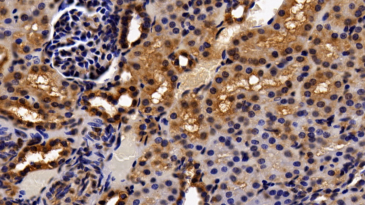Histone Deacetylase 1 (HDAC1) Monoclonal Antibody - image 5