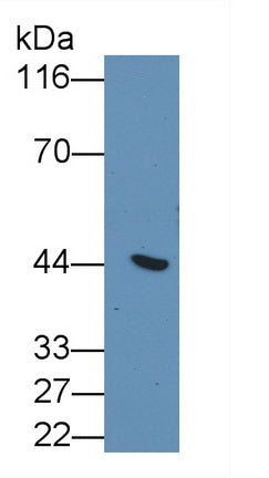 Cytokeratin 19 (CK19) Monoclonal Antibody - image 2