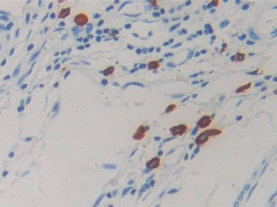 Western Blot; Sample: Human Urine Primary Ab: 1ug/ml Mouse Anti-Human RETN Antibody Second Ab: 0.2ug/mL HRP-Linked Caprine Anti-Mouse IgG Polyclonal Antibody