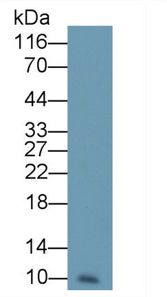 Resistin (RETN) Monoclonal Antibody - image 4