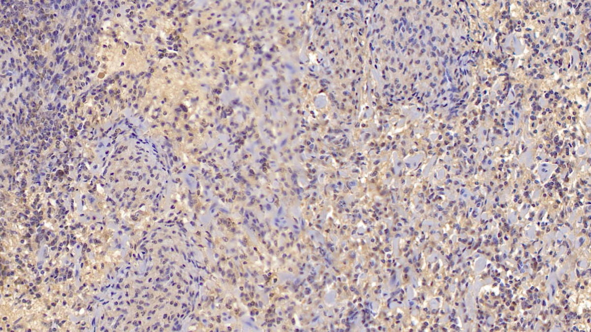 Interleukin 10 (IL10) Monoclonal Antibody - image 2