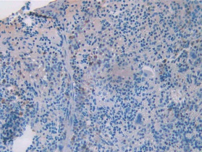 DAB staining on IHC-P; Sample: Mouse Stomach Tissue; Primary Ab: 40ug/ml Mouse Anti-Mouse RETN Antibody; Second Ab: 2ug/mL HRP-Linked Caprine Anti-Mouse IgG Polyclonal Antibody