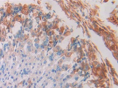 Resistin (RETN) Monoclonal Antibody - image 3
