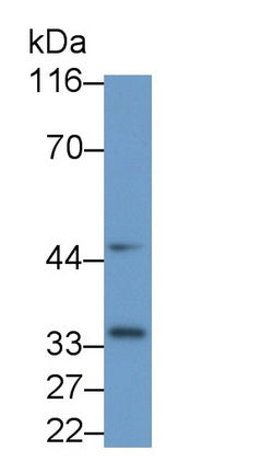 Interleukin 1 Beta (IL1b) Monoclonal Antibody - image 2