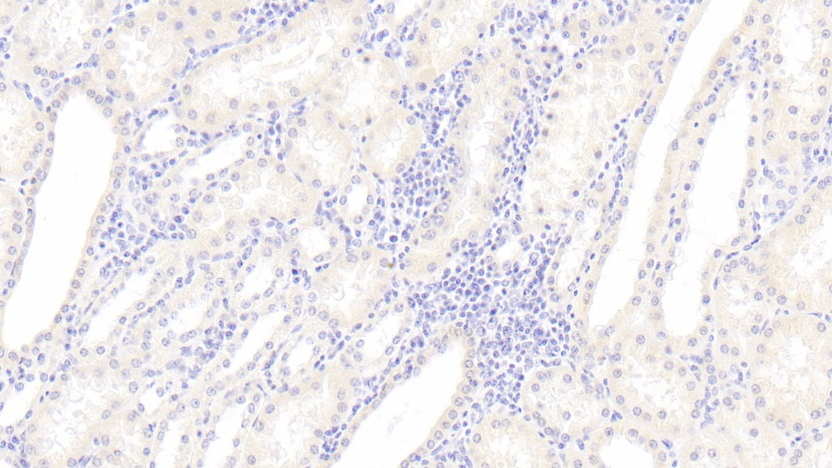 DAB staining on IHC-P; Sample: Human Liver Tissue; Primary Ab: 20ug/ml Mouse Anti-Human HRG Antibody; Second Ab: 2ug/mL HRP-Linked Caprine Anti-Mouse IgG Polyclonal Antibody