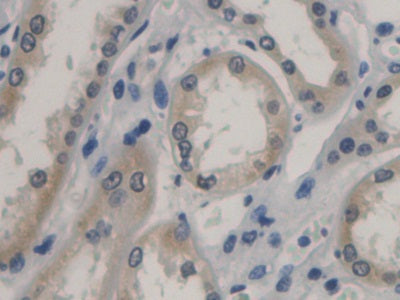 DAB staining on IHC-P; Sample: Human Pancreas Tissue; Primary Ab: 30ug/ml Mouse Anti-Human PCT Antibody; Second Ab: 2ug/mL HRP-Linked Caprine Anti-Mouse IgG Polyclonal Antibody